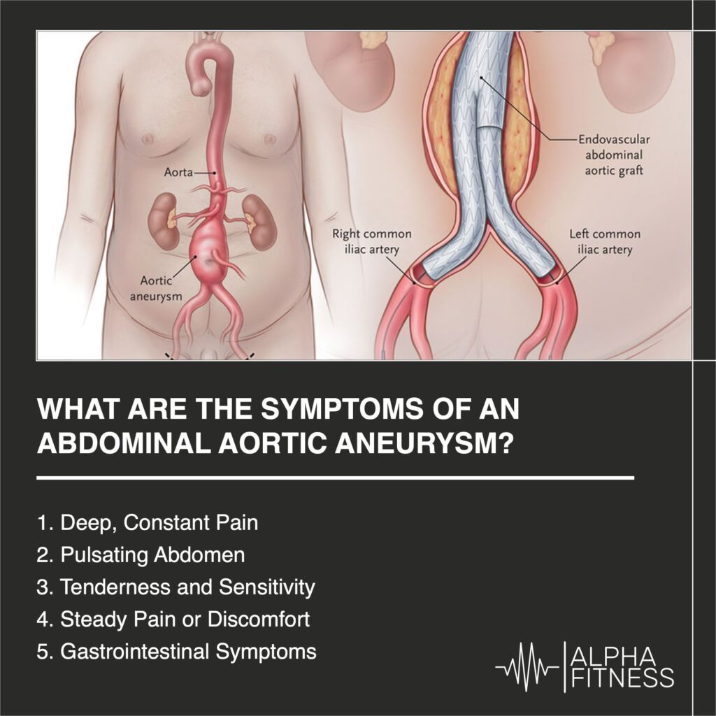 What are the symptoms of an abdominal aortic aneurysm? - AlphaFitness.Health
